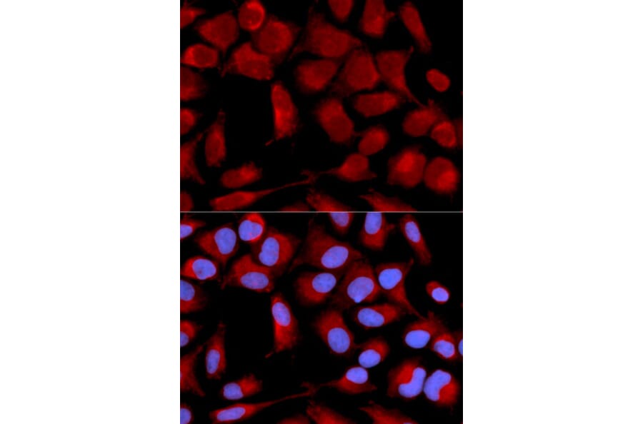 Immunofluorescence - Anti-PDHA1 Antibody (A13525) - Antibodies.com