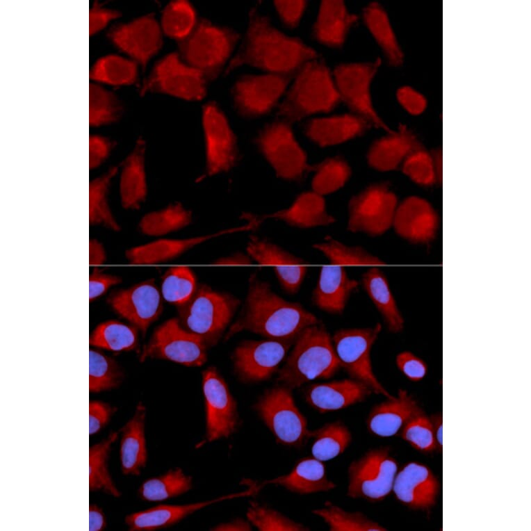 Immunofluorescence - Anti-PDHA1 Antibody (A13525) - Antibodies.com