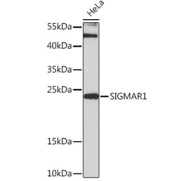 Western Blot - Anti-Sigma1-receptor Antibody (A92365) - Antibodies.com