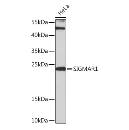 Western Blot - Anti-Sigma1-receptor Antibody (A92365) - Antibodies.com