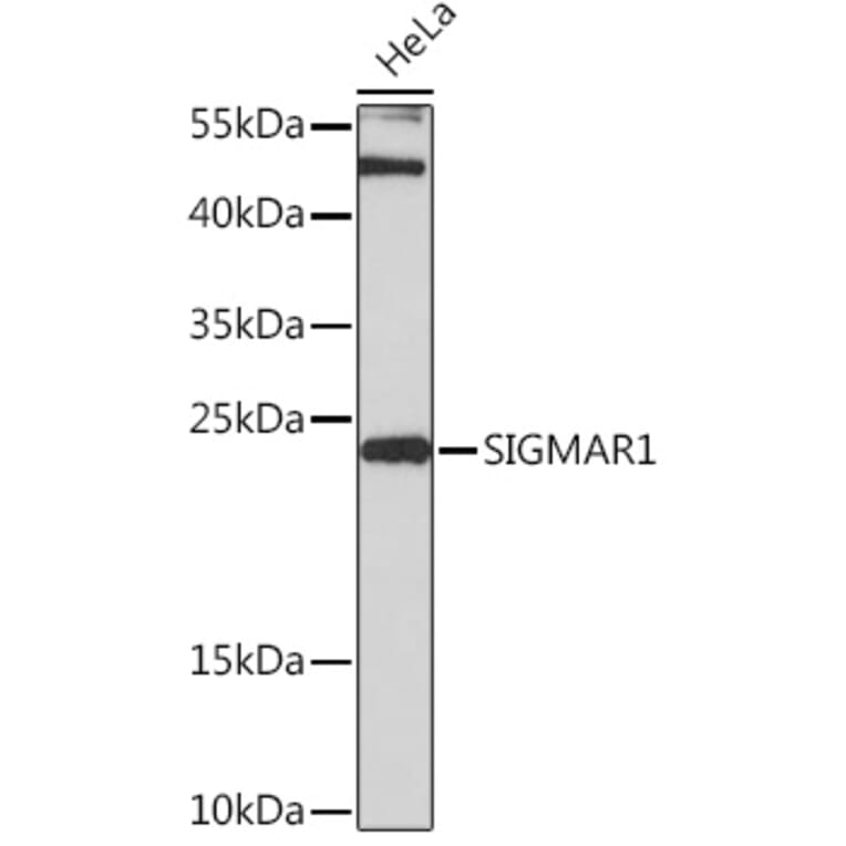 Western Blot - Anti-Sigma1-receptor Antibody (A92365) - Antibodies.com