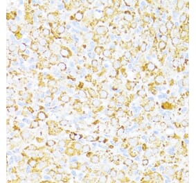 Immunohistochemistry - Anti-ALDH6A1 Antibody (A92368) - Antibodies.com