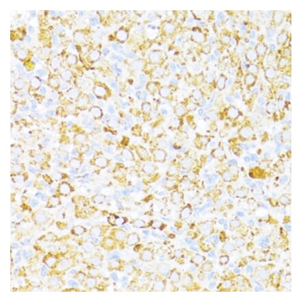 Immunohistochemistry - Anti-ALDH6A1 Antibody (A92368) - Antibodies.com