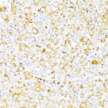 Immunohistochemistry - Anti-ALDH6A1 Antibody (A92368) - Antibodies.com