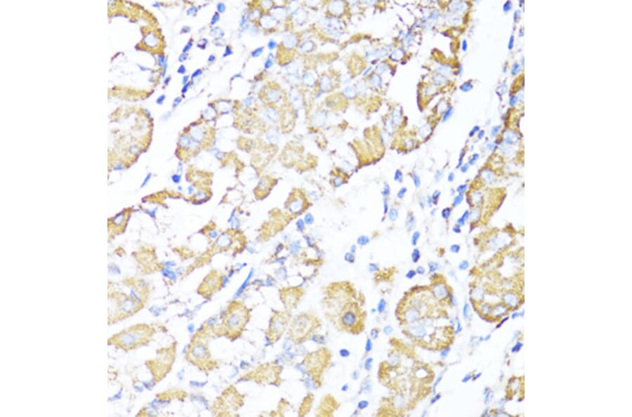 Immunohistochemistry - Anti-ALDH6A1 Antibody (A92368) - Antibodies.com