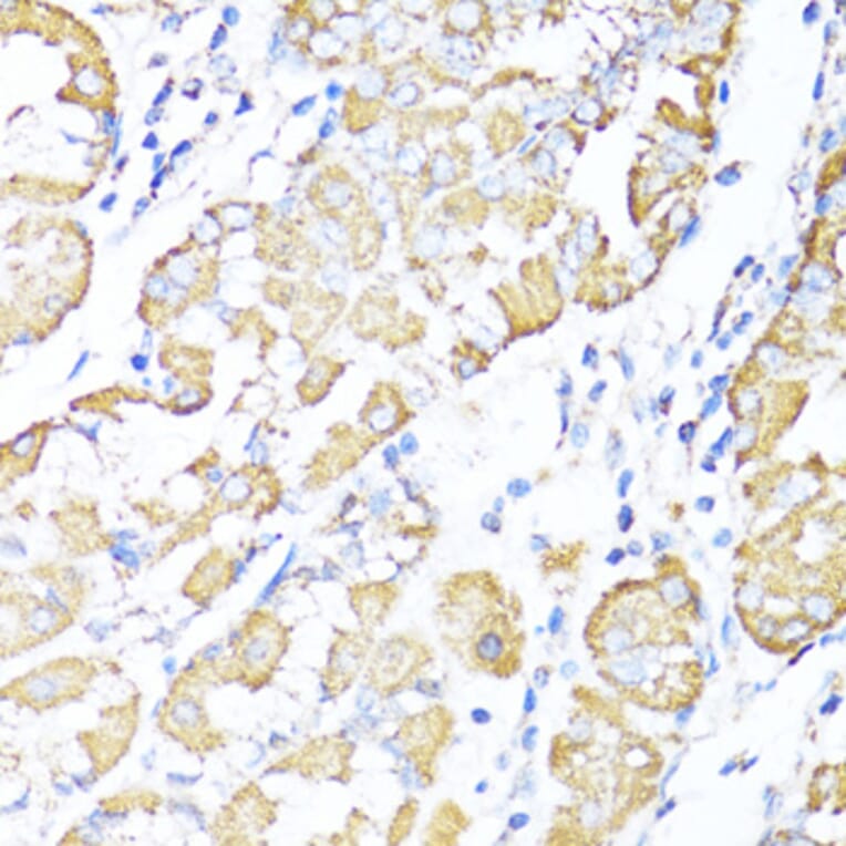 Immunohistochemistry - Anti-ALDH6A1 Antibody (A92368) - Antibodies.com