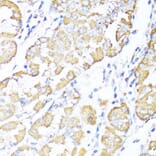 Immunohistochemistry - Anti-ALDH6A1 Antibody (A92368) - Antibodies.com