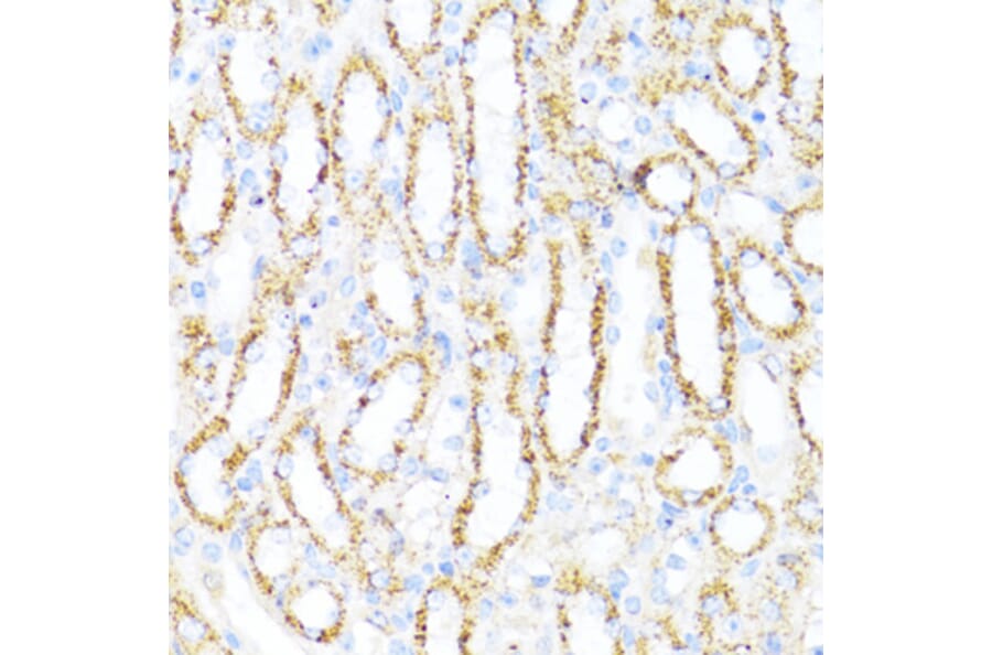 Immunohistochemistry - Anti-ALDH6A1 Antibody (A92368) - Antibodies.com
