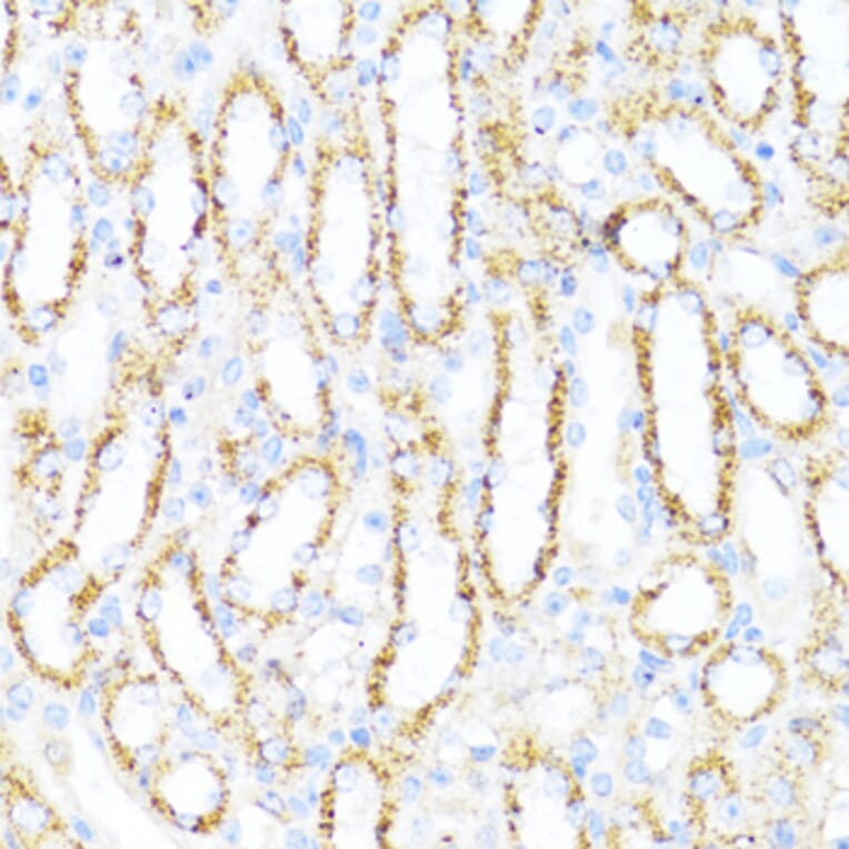 Immunohistochemistry - Anti-ALDH6A1 Antibody (A92368) - Antibodies.com
