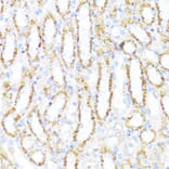 Immunohistochemistry - Anti-ALDH6A1 Antibody (A92368) - Antibodies.com