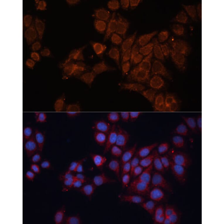 Immunofluorescence - Anti-ALDH6A1 Antibody (A92368) - Antibodies.com