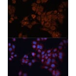 Immunofluorescence - Anti-ALDH6A1 Antibody (A92368) - Antibodies.com