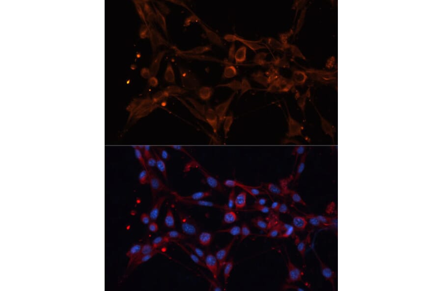 Immunofluorescence - Anti-ALDH6A1 Antibody (A92368) - Antibodies.com