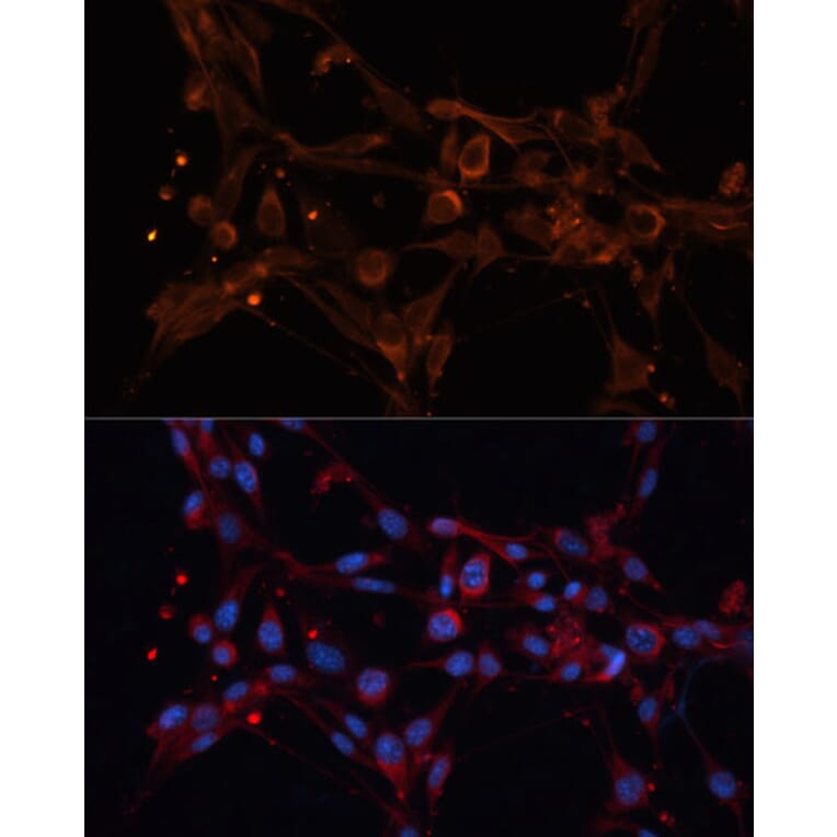 Immunofluorescence - Anti-ALDH6A1 Antibody (A92368) - Antibodies.com