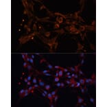 Immunofluorescence - Anti-ALDH6A1 Antibody (A92368) - Antibodies.com