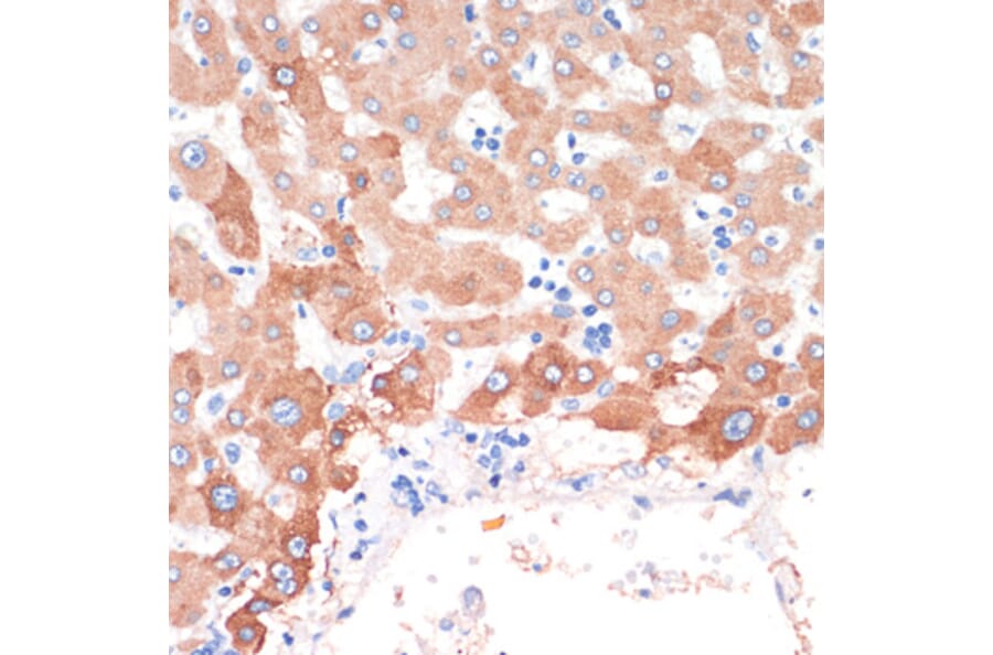 Immunohistochemistry - Anti-Choline Acetyltransferase Antibody (A92370) - Antibodies.com