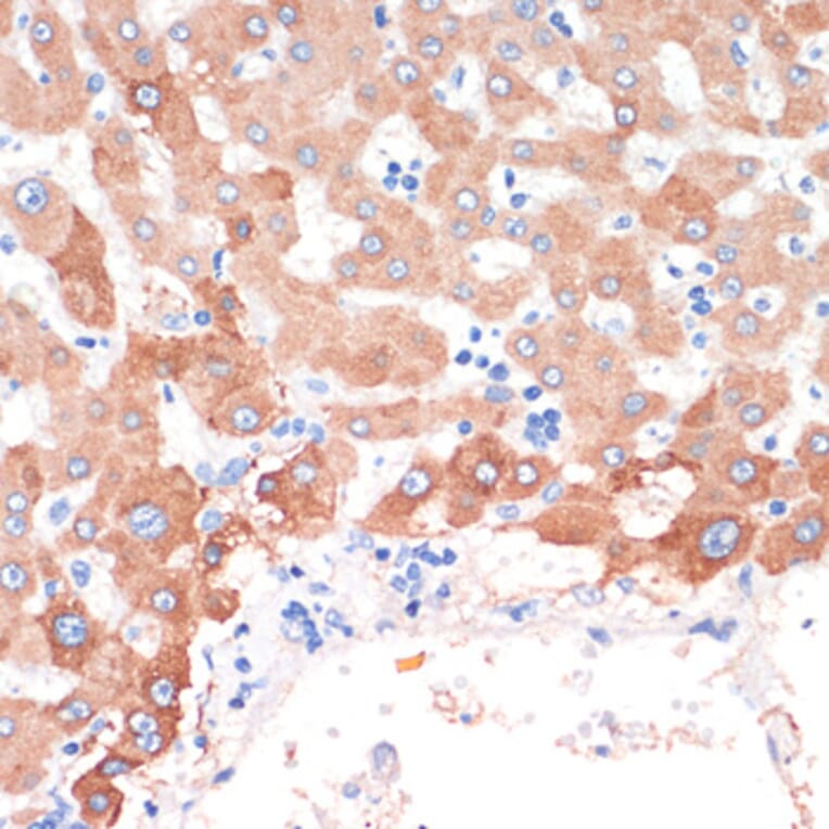 Immunohistochemistry - Anti-Choline Acetyltransferase Antibody (A92370) - Antibodies.com