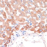 Immunohistochemistry - Anti-Choline Acetyltransferase Antibody (A92370) - Antibodies.com