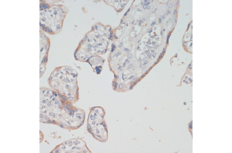 Immunohistochemistry - Anti-Choline Acetyltransferase Antibody (A92370) - Antibodies.com