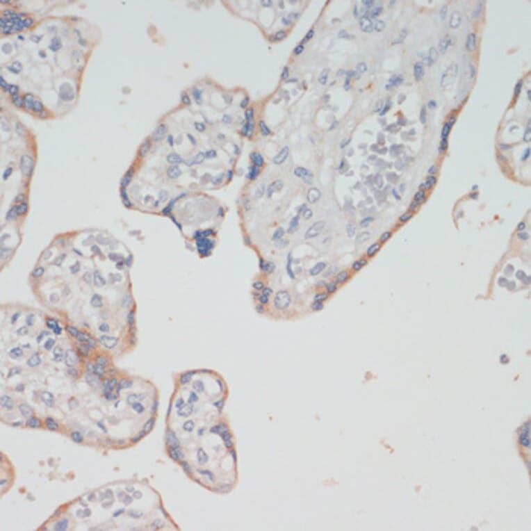 Immunohistochemistry - Anti-Choline Acetyltransferase Antibody (A92370) - Antibodies.com