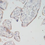 Immunohistochemistry - Anti-Choline Acetyltransferase Antibody (A92370) - Antibodies.com