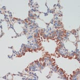 Immunohistochemistry - Anti-Choline Acetyltransferase Antibody (A92370) - Antibodies.com