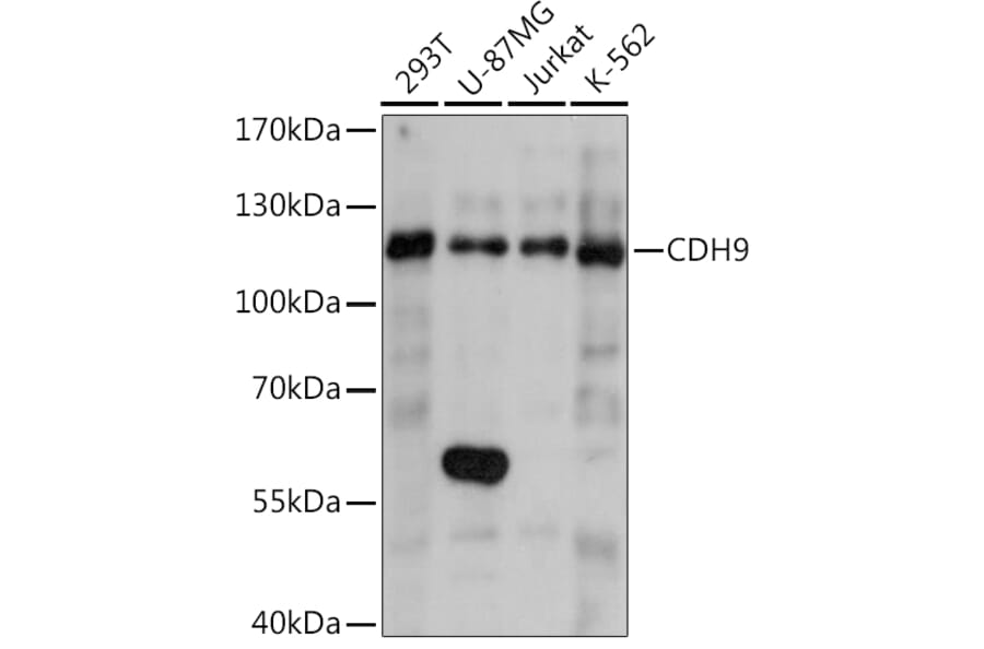 Western Blot - Anti-Cadherin 9 Antibody (A92372) - Antibodies.com
