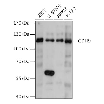 Western Blot - Anti-Cadherin 9 Antibody (A92372) - Antibodies.com