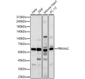 Western Blot - Anti-AMPK alpha 2 Antibody (A92373) - Antibodies.com