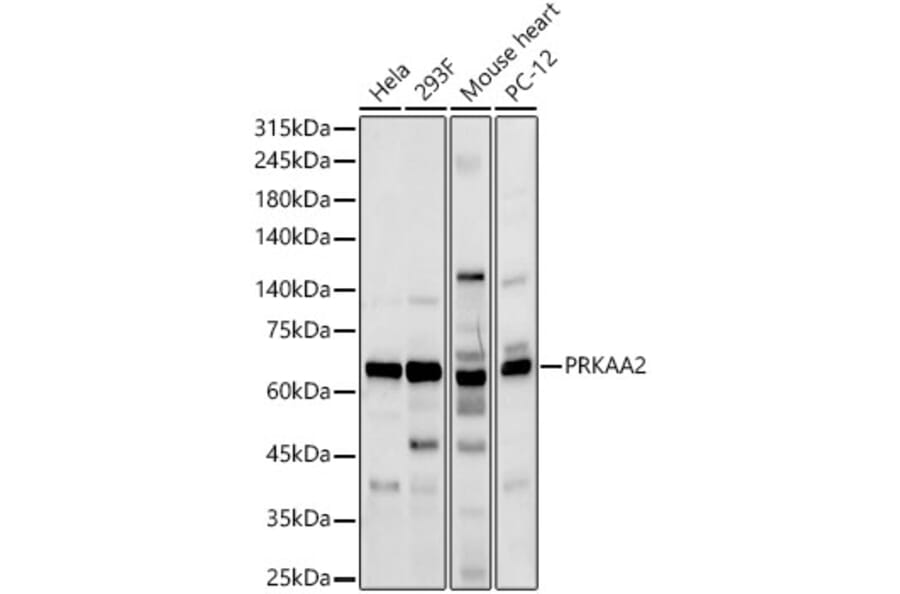 Western Blot - Anti-AMPK alpha 2 Antibody (A92373) - Antibodies.com