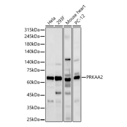 Western Blot - Anti-AMPK alpha 2 Antibody (A92373) - Antibodies.com