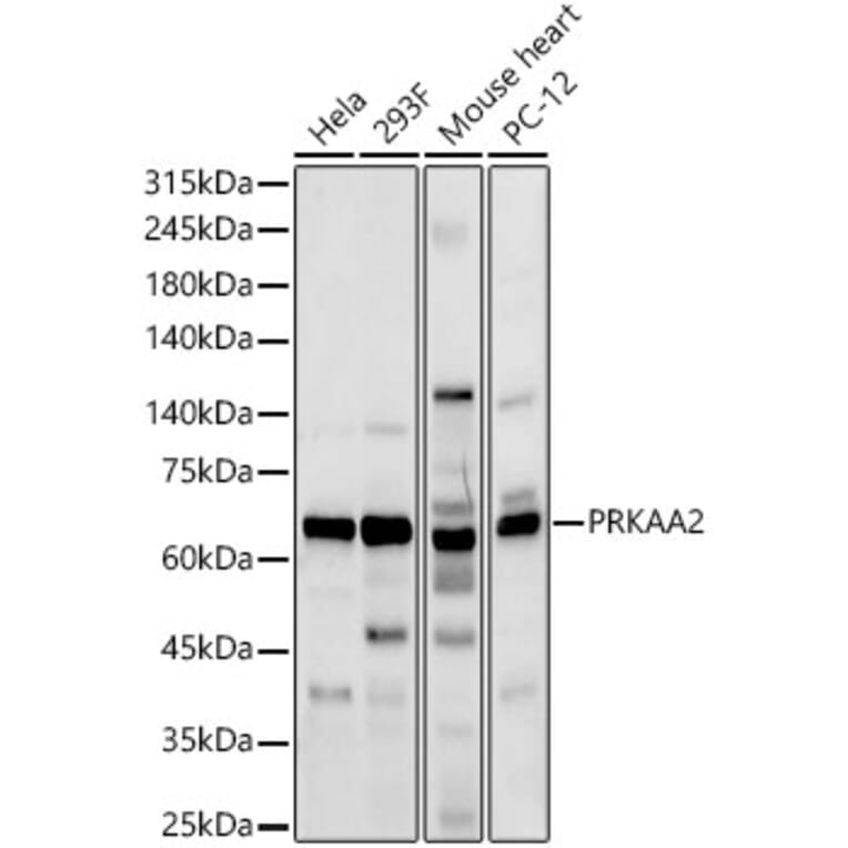 Western Blot - Anti-AMPK alpha 2 Antibody (A92373) - Antibodies.com