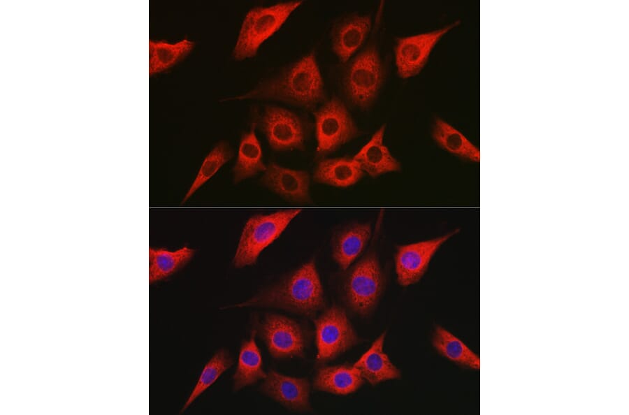 Immunofluorescence - Anti-AMPK alpha 2 Antibody (A92373) - Antibodies.com