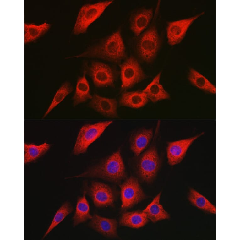 Immunofluorescence - Anti-AMPK alpha 2 Antibody (A92373) - Antibodies.com