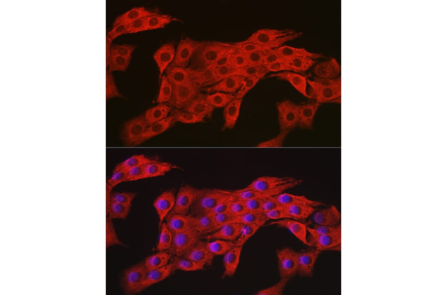 Immunofluorescence - Anti-AMPK alpha 2 Antibody (A92373) - Antibodies.com