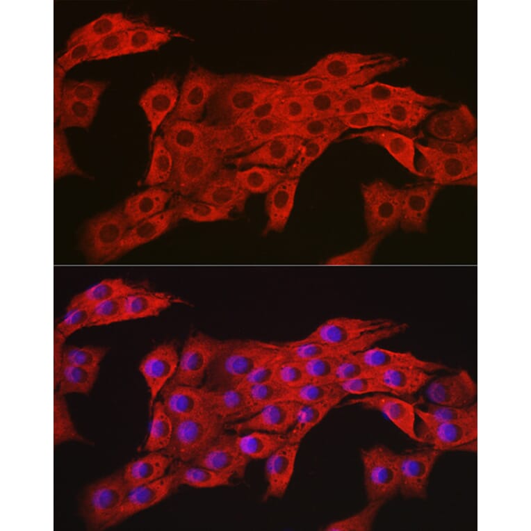 Immunofluorescence - Anti-AMPK alpha 2 Antibody (A92373) - Antibodies.com