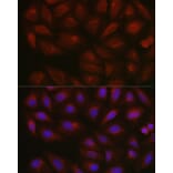 Immunofluorescence - Anti-AMPK alpha 2 Antibody (A92373) - Antibodies.com