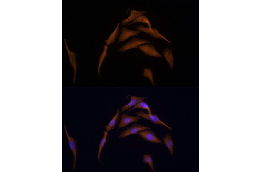 Immunofluorescence - Anti-AMPK alpha 2 Antibody (A92373) - Antibodies.com