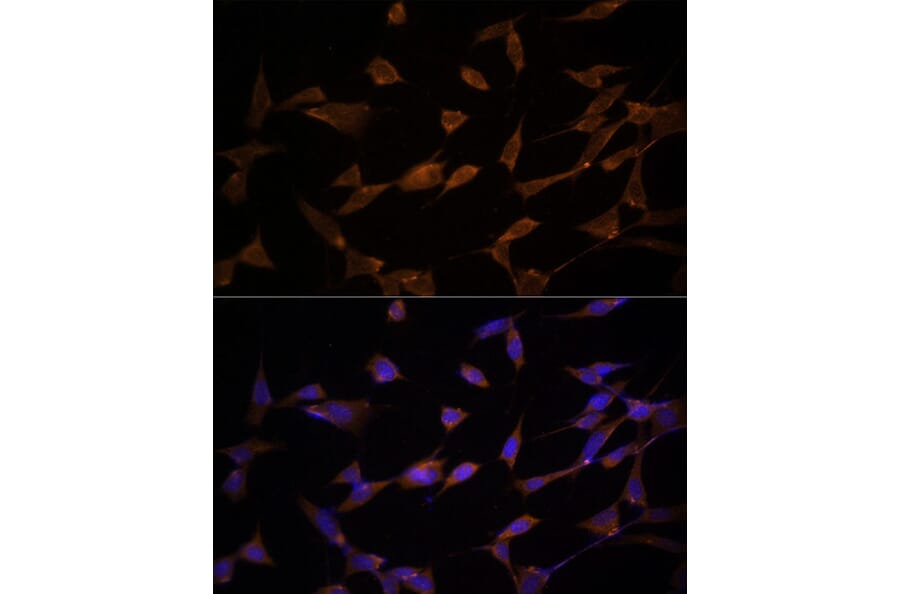 Anti-AMPK alpha 2 Antibody (A92373) | Antibodies.com