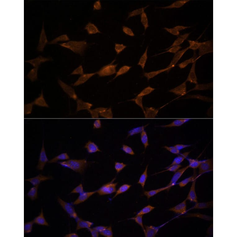 Immunofluorescence - Anti-AMPK alpha 2 Antibody (A92373) - Antibodies.com