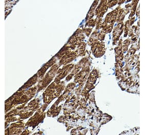 Immunohistochemistry - Anti-BRAF Antibody (A92376) - Antibodies.com