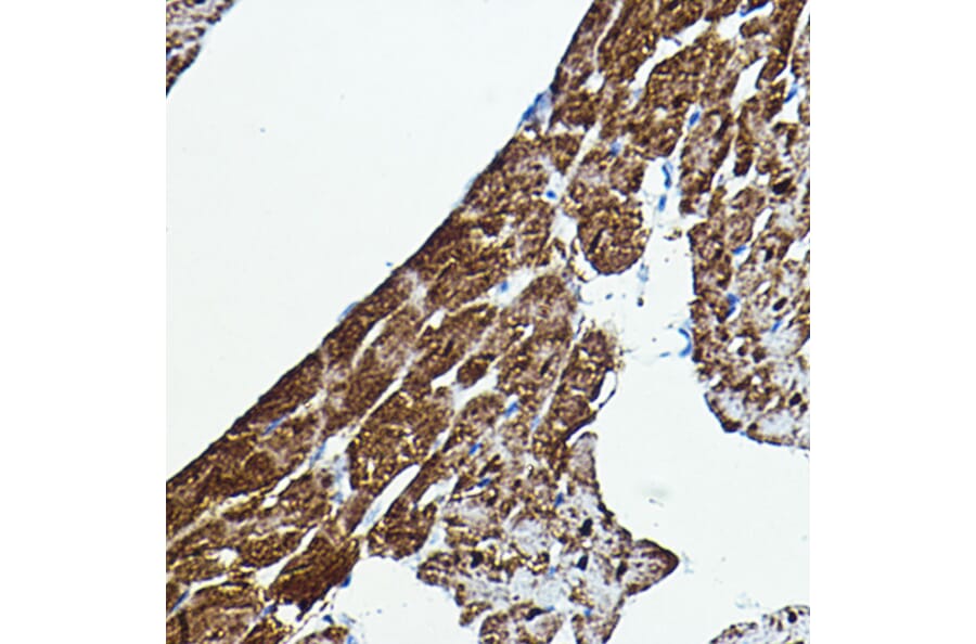 Immunohistochemistry - Anti-BRAF Antibody (A92376) - Antibodies.com