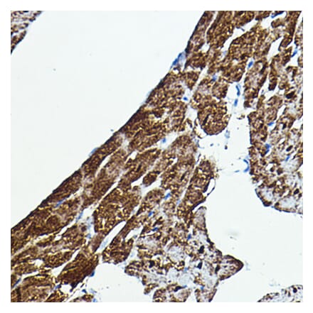 Immunohistochemistry - Anti-BRAF Antibody (A92376) - Antibodies.com