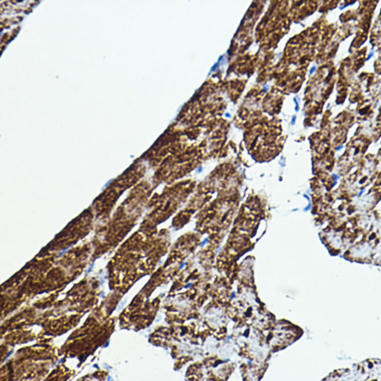 Immunohistochemistry - Anti-BRAF Antibody (A92376) - Antibodies.com