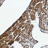 Immunohistochemistry - Anti-BRAF Antibody (A92376) - Antibodies.com
