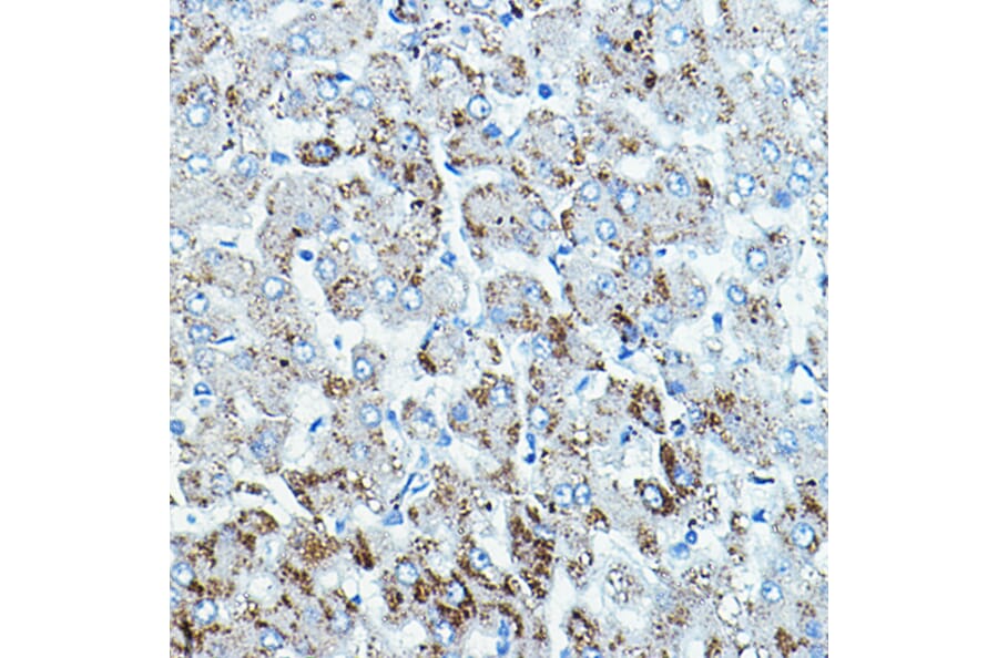 Immunohistochemistry - Anti-BRAF Antibody (A92376) - Antibodies.com