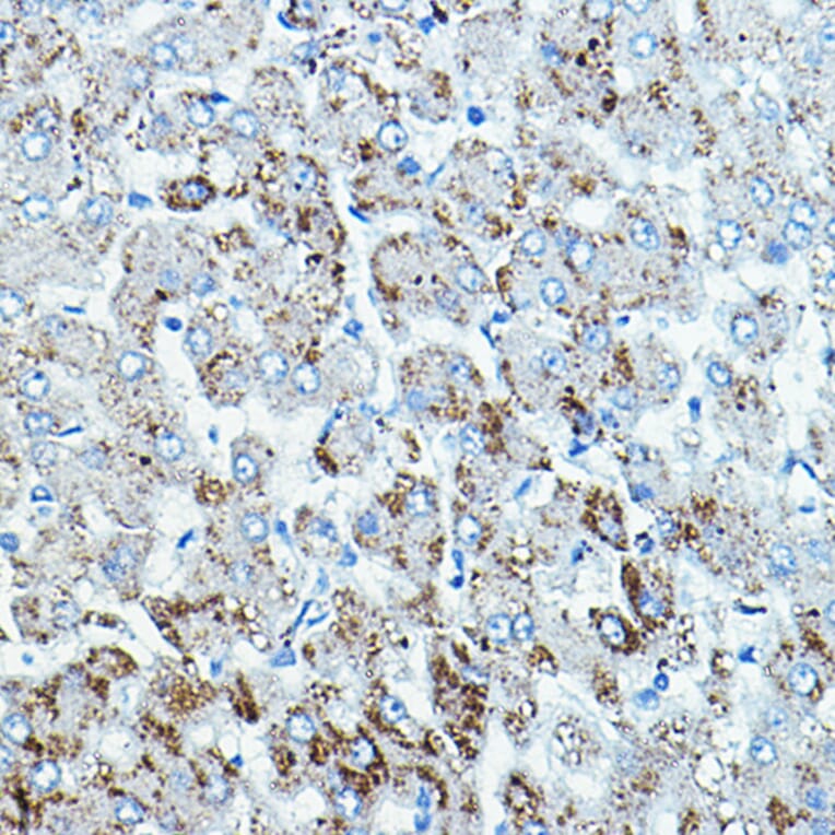 Immunohistochemistry - Anti-BRAF Antibody (A92376) - Antibodies.com