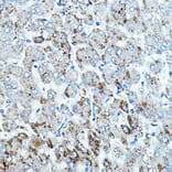 Immunohistochemistry - Anti-BRAF Antibody (A92376) - Antibodies.com