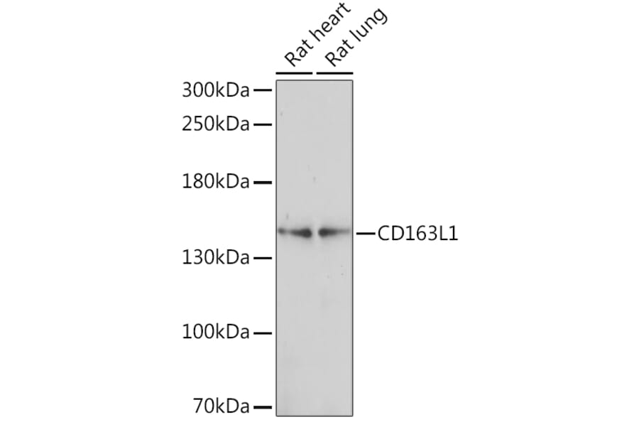 Western Blot - Anti-CD163L1 Antibody (A92378) - Antibodies.com