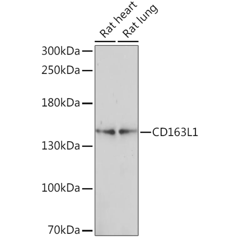 Western Blot - Anti-CD163L1 Antibody (A92378) - Antibodies.com